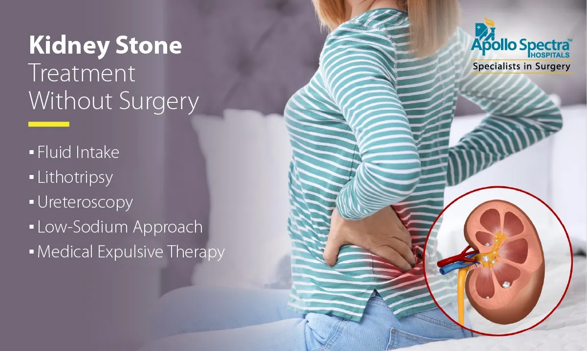 Kidney Stone Treatment Without Surgery